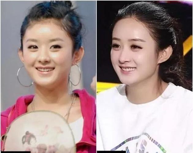 赵丽颖整容前后照片,赵丽颖出道前照片对比,本文共(1818字) 赵丽颖整容前后照片,赵丽颖出道前照片对比,本文共(1818字)