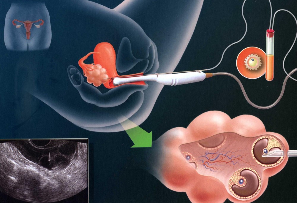 卵妹是什么意思,什么叫卵妹 