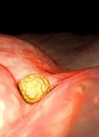 高龄产子蔡少芬为什么愿意生三胎(46岁蔡少芬再度怀孕)(5)