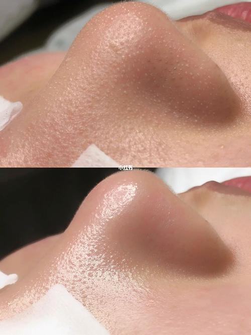 彻底清洁毛孔的方法（正确清洁毛孔）