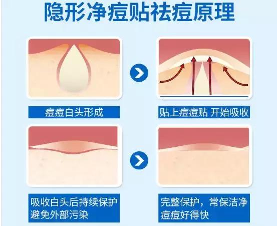 祛痘印痘疤最有用的产品(亲测上百款祛痘产品)(10)