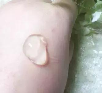 祛痘印痘疤最有用的产品(亲测上百款祛痘产品)(13)