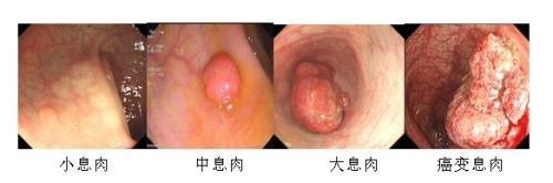 吃酵素梅子能减肥吗(女子吃蜜饯酵素梅)(4)