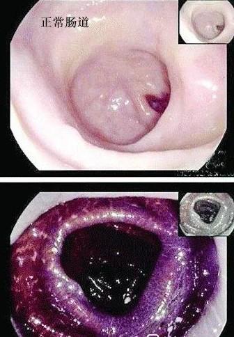 吃酵素梅子能减肥吗(女子吃蜜饯酵素梅)(6)