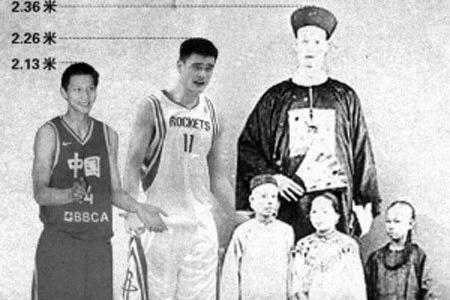 人类最大的骨头(10个拥有罕见身体特征的人类)(11)