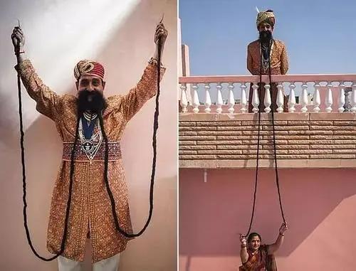 人类最大的骨头(10个拥有罕见身体特征的人类)(14)