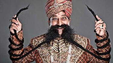 人类最大的骨头(10个拥有罕见身体特征的人类)(15)