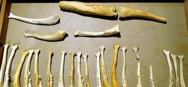 人类最大的骨头(10个拥有罕见身体特征的人类)(20)