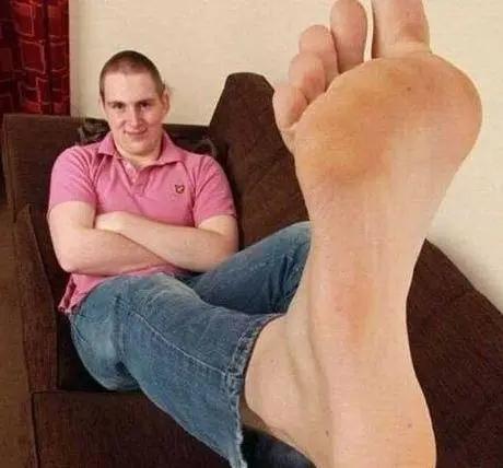 人类最大的骨头(10个拥有罕见身体特征的人类)(9)