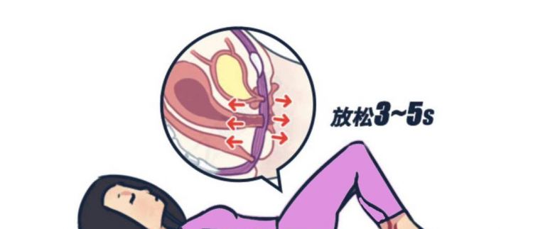 如何锻炼盆底肌防止漏尿