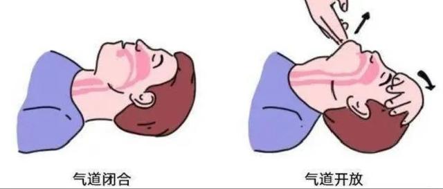 溺水急救的正确方式(正确的溺水急救方法)(3)