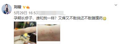 刘璇二胎生产过程曝光(40岁刘璇怀二胎肚子长满红疹)(8)