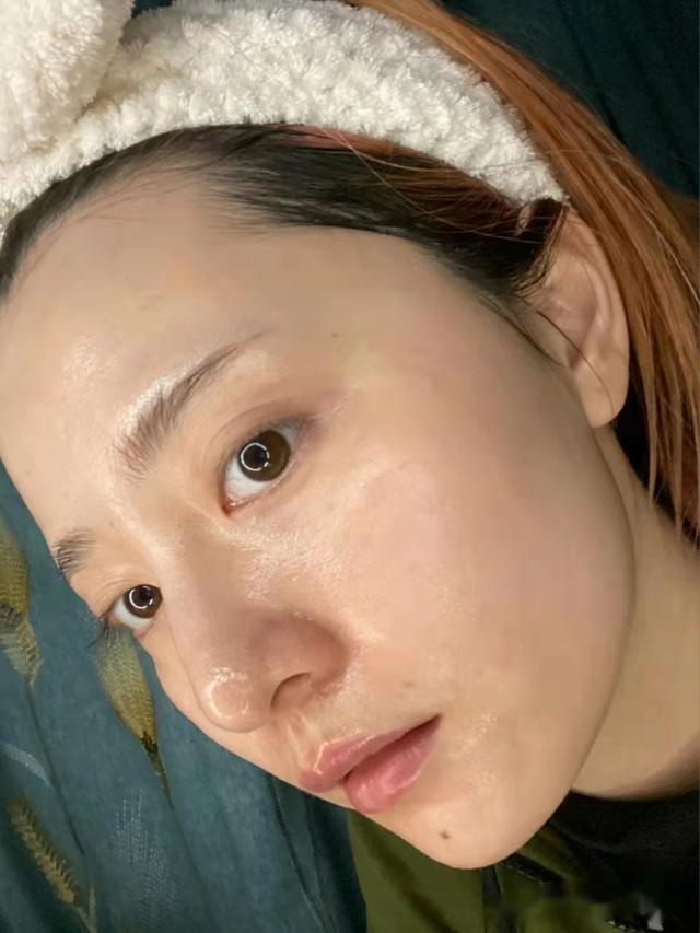 如何让皮肤变得水嫩光滑(有助于肌肤变年轻的)(3)