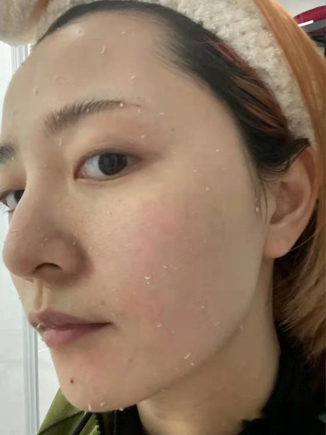 如何让皮肤变得水嫩光滑(有助于肌肤变年轻的)(2)