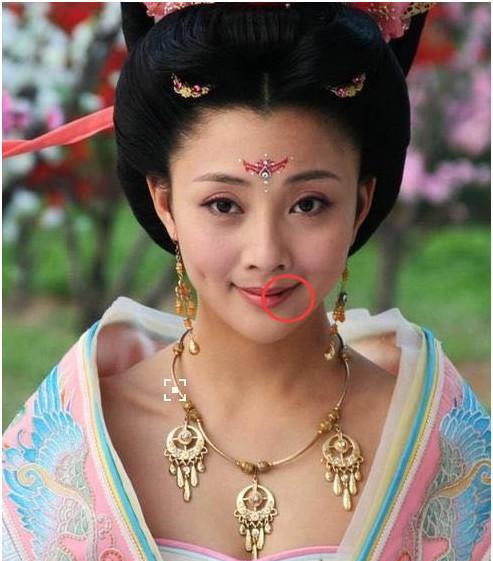 殷桃的嘴怎么了