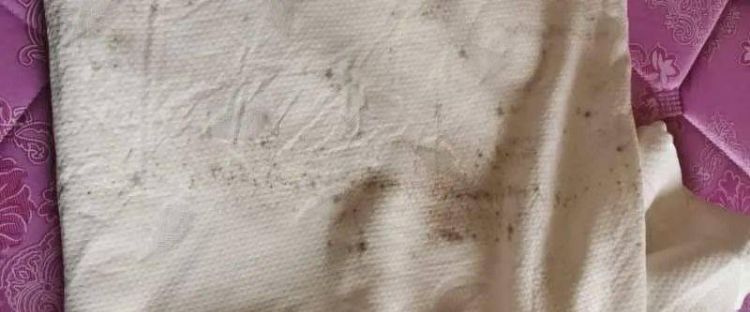 床单上发霉的黑点怎么去掉