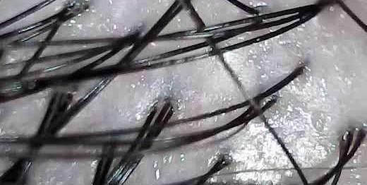 怎么去头油,头发出油多,还有异味,吃什么食物能去头油?图6