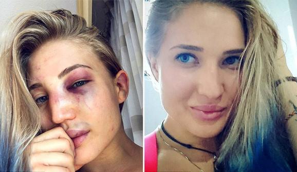 她是俄罗斯泰拳王，颜值与实力并存，因李小龙电影走上格斗道路