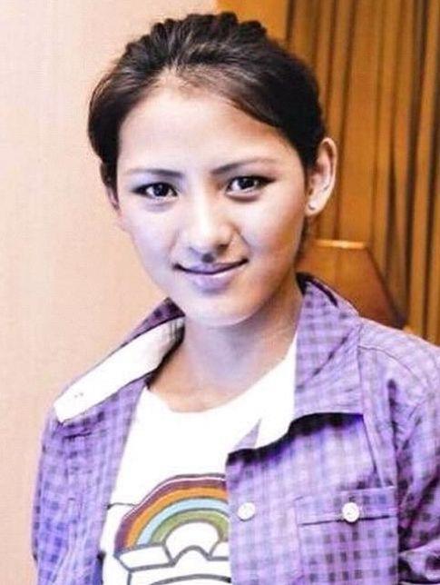 堪称网红界扛把子的张予曦,整前旧照被扒,网友:求介绍整容医生