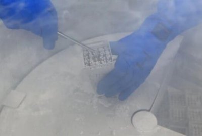 国内冻卵子需要多少钱 具体收费标准整理