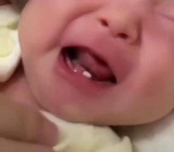 女婴出生长两颗牙是真的吗 女婴出生长两颗牙怎么回事