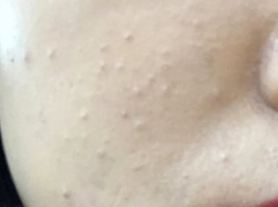 误区!很多人误以为它是闭口,来看看你是不是也认错了