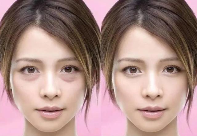 下眼袋松弛怎么办简单去眼袋方法(女人长眼袋太显老)(1)