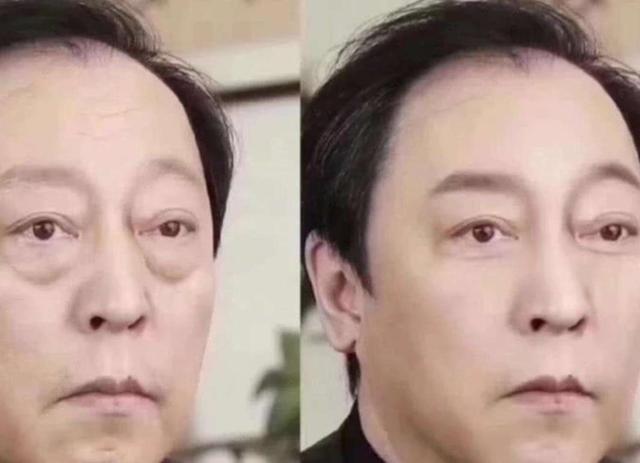 下眼袋松弛怎么办简单去眼袋方法(女人长眼袋太显老)(8)