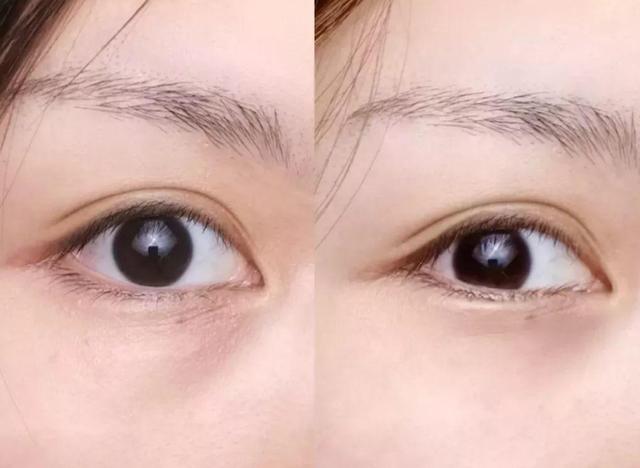 下眼袋松弛怎么办简单去眼袋方法(女人长眼袋太显老)(18)