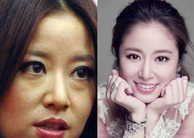 下眼袋松弛怎么办简单去眼袋方法(女人长眼袋太显老)(2)