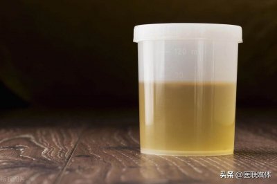 小便时发现有泡沫,是生病了?先别慌,多半是这4种原因