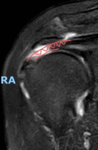 ​运动下就好了！女子忍着剧痛每天勤锻炼，结果出乎意料