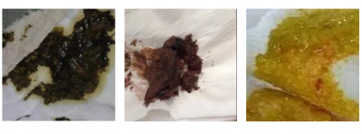 ​辨别奶粉真假方法（怎么判断奶粉真假？刚开始喝奶粉会恶心吐奶？喝牛奶嘴巴圈