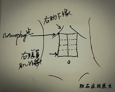 ​图说“胆囊”