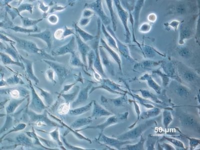 ​海拉细胞：人死了，细胞还活着，至今已分裂5000万吨，拯救上亿人