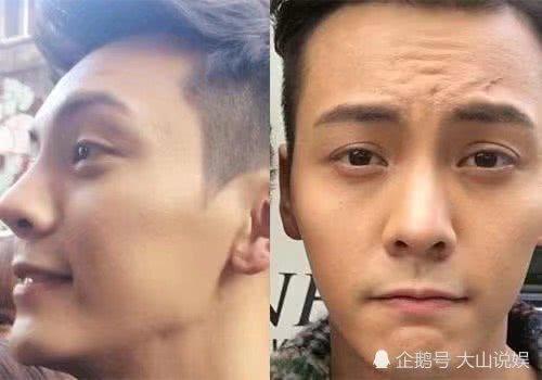 陈伟霆素颜，朱正廷素颜，终于知道小鲜肉浓妆出镜的原因了